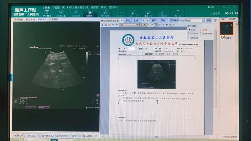 职业体检项目主要包括以下几类：